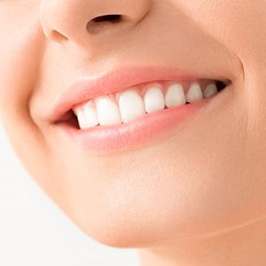 Teeth whitening