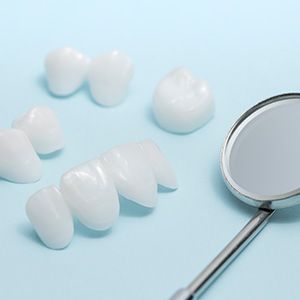 Veneers and Lumineers